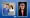 happy-patient-idh-smile-antalya-5.webp