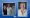 happy-patient-idh-smile-antalya-6.webp