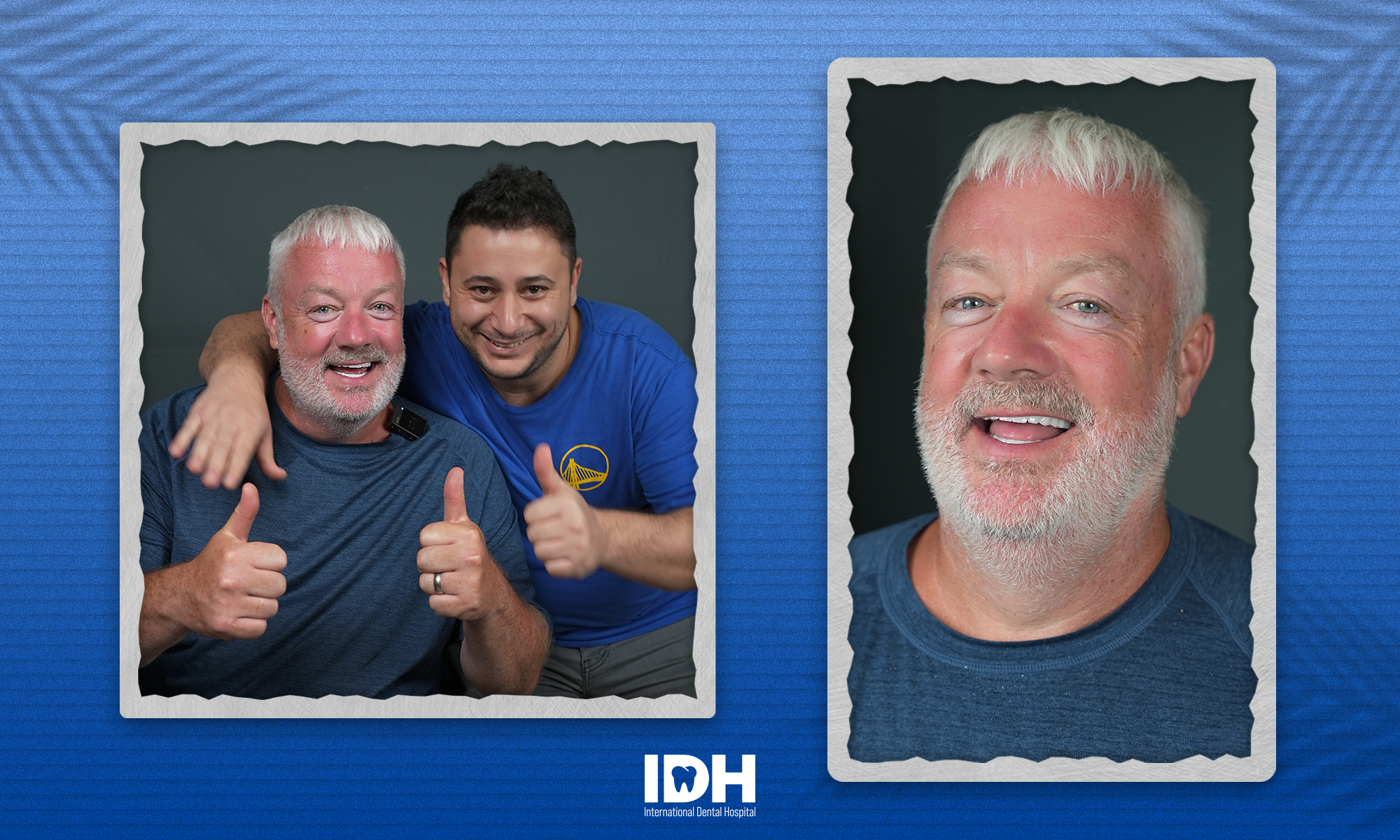 happy-patient-idh-smile-antalya-7.webp